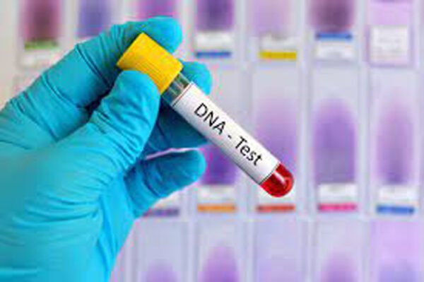 dna test e1679982942914 अफेयर से पैदा हुई बेटी, डीएनए टेस्ट में खुली असलियत तो सदमे में आ गई औलाद!
