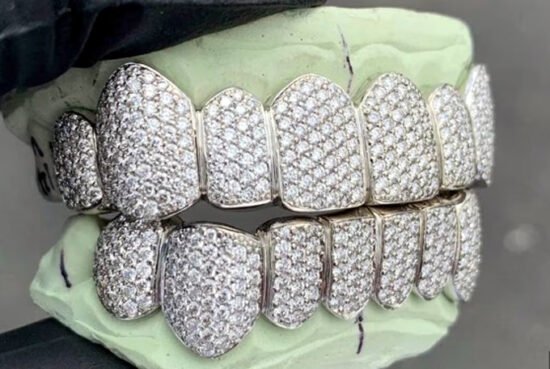 diamond tooth e1682496242496 1 लाख से लेकर 25 लाख रुपयों की हीरे की बत्तीसी