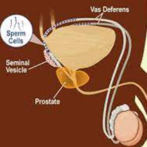 sperms.jpeg शुक्राणु/स्पर्म बढ़ाने के उपाय 