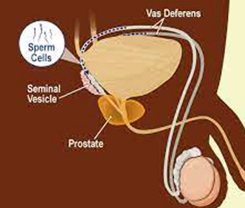 sperms.jpeg e1691993428357 शुक्राणु/स्पर्म बढ़ाने के उपाय 