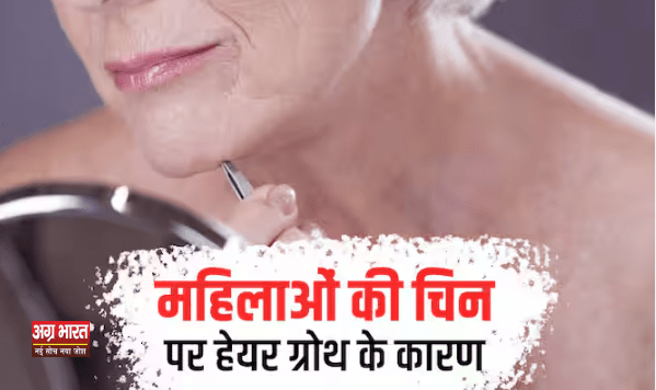 hair on chin क्या है पीरियड्स और ठोड़ी पर बाल का कनेक्शन? महिलाएं न करें इसे नजरअंदाज